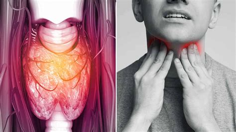 10 Signs Of Throat Cancer To Never Ignore Power Of Positivity 10 Signs Of Throat Cancer To Never Ignore Power Of Positivity
