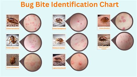 8 Type Of Bed Bug Bites Identification Chart With Picture