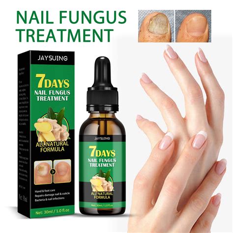 Best Otc Fingernail Fungus Treatment