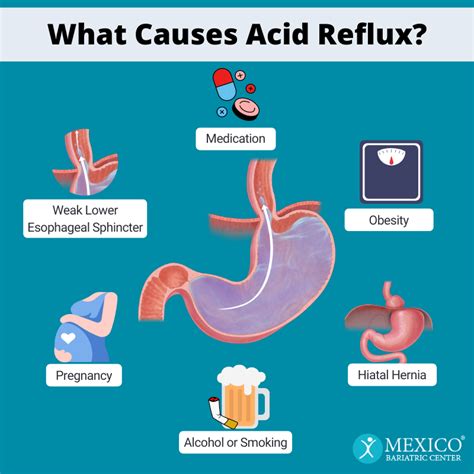 Causes Of Acid Reflux