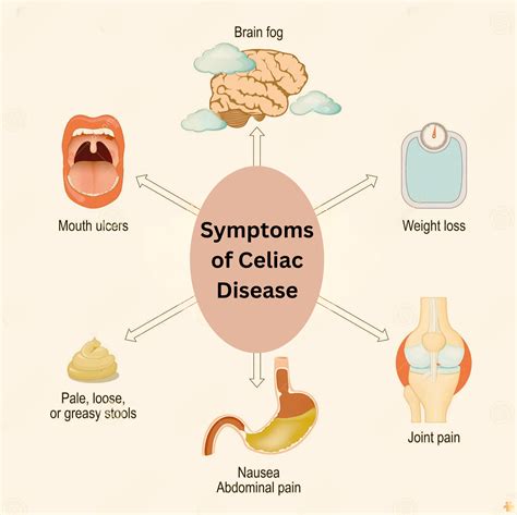 Celiac Disease What You Need To Know Celiac Disease What You Need To Know