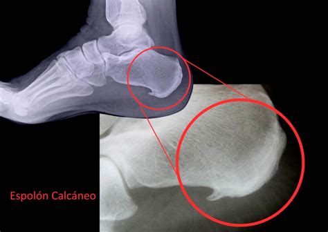 Chicken El Espolon Chicken El Espolon