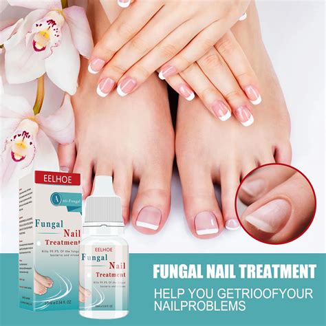 Child Fingernail Fungus Treatment At Maddison Chapman Blog Child Fingernail Fungus Treatment At Maddison Chapman Blog
