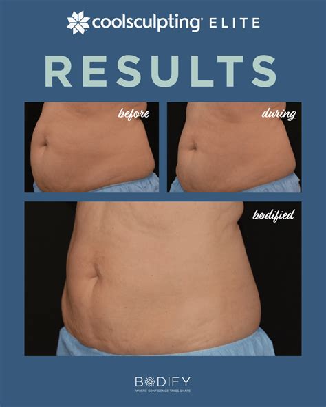 Five Tips For A Great Summer Body Bodify Coolsculpting Medical Spa Five Tips For A Great Summer Body Bodify Coolsculpting Medical Spa