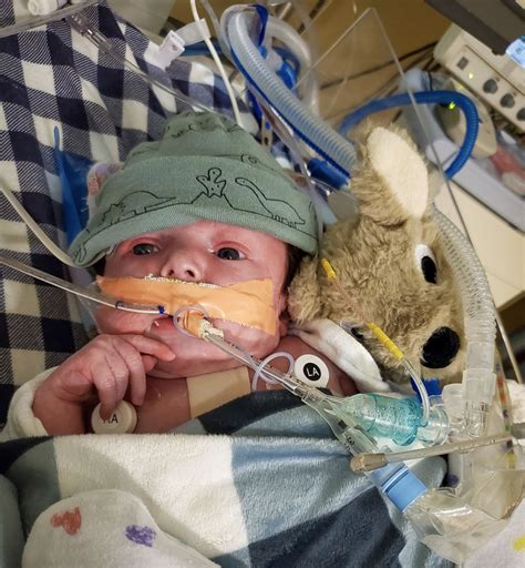 Rifle Couple Stays Strong As Their Newborn Son Recovers From Open Heart Surgery In Denver Aspentimes Com Rifle Couple Stays Strong As Their Newborn Son Recovers From Open Heart Surgery In Denver Aspentimes Com