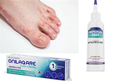 Roycederm Tratamiento De Ti A Versicolor Tratamiento De Pie De Atleta Roycederm Tratamiento De Ti A Versicolor Tratamiento De Pie De Atleta