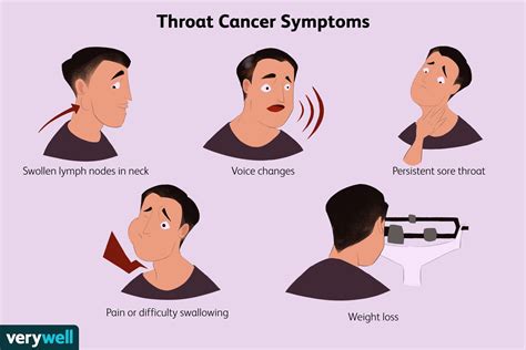 Throat Cancer Signs Throat Cancer Signs