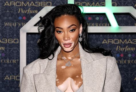 Winnie Harlow Looks Like Art In Flawless New Magazine Photos Winnie Harlow Looks Like Art In Flawless New Magazine Photos